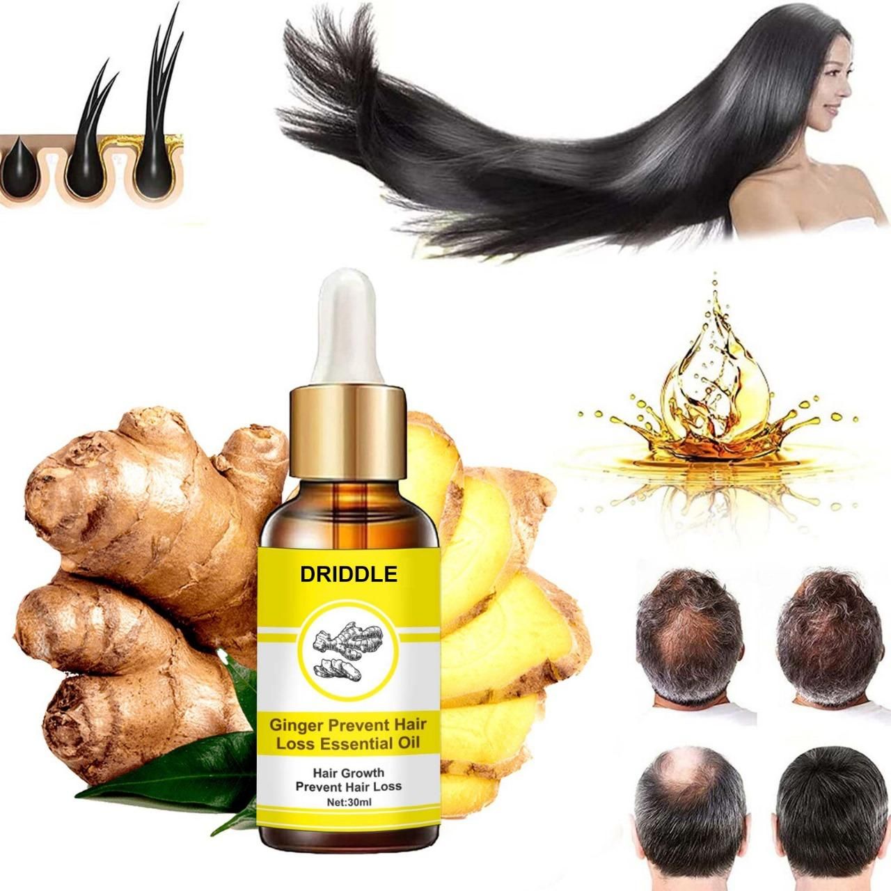 Ginger Prevent Hair Loss Essential Oil (Pack of 1)