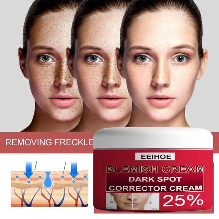EEIHOE Blemish Cream Dark Spot Corrector Cream - 50gms (Pack of 1)