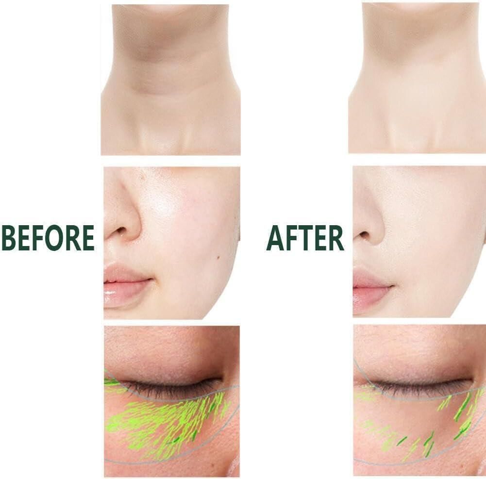 2-In-1 Anti-Wrinkle Facial Massager For Skin Care