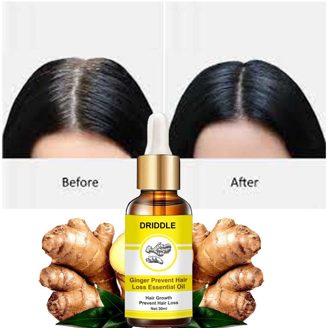 Ginger Prevent Hair Loss Essential Oil (Pack of 1)
