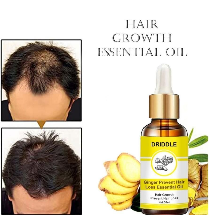 Ginger Prevent Hair Loss Essential Oil (Pack of 1)