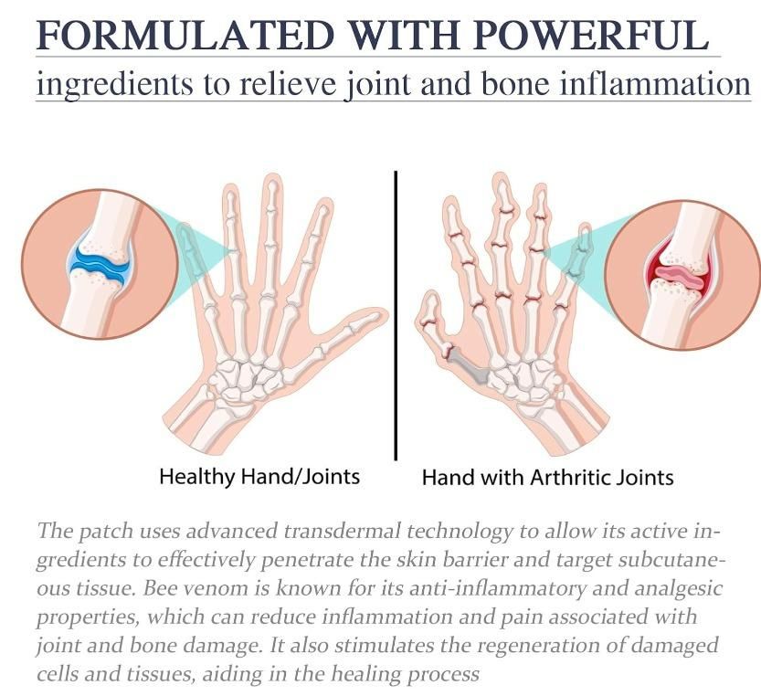 Bee Venom Pain and Bone Healing Cream - 30Gm (Pack Of 1)