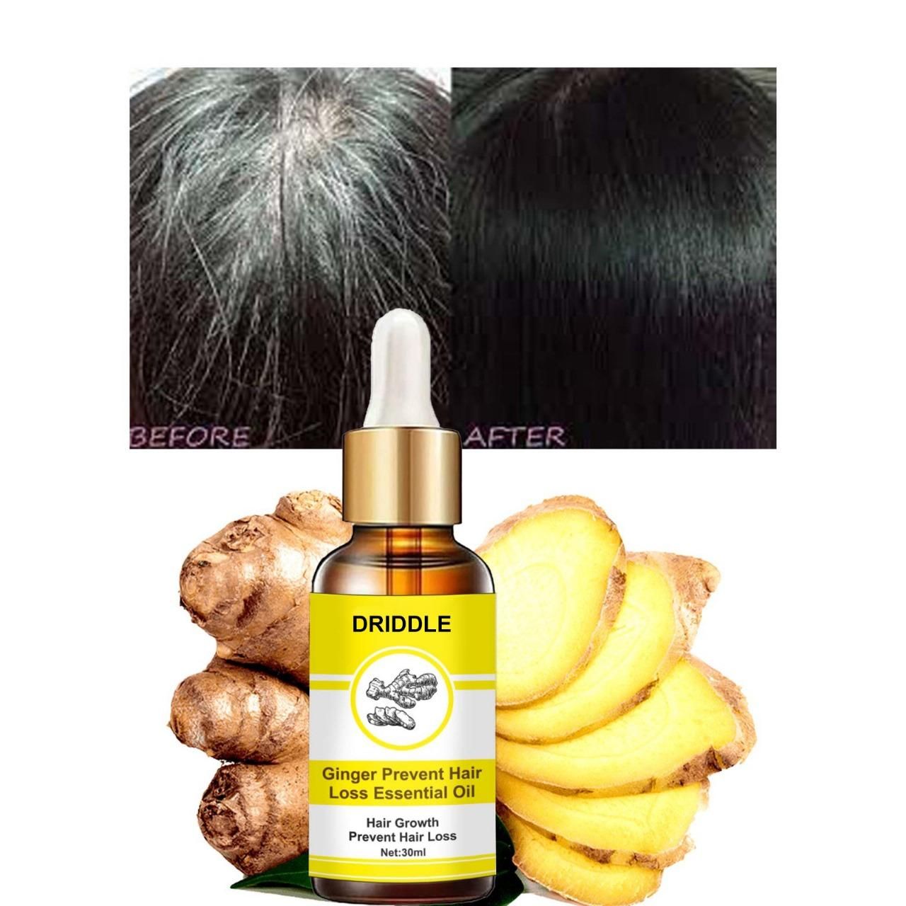 Ginger Prevent Hair Loss Essential Oil  (Pack of 1)